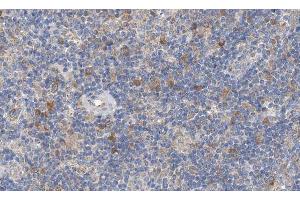 ABIN6266885 at 1/100 staining human lymph node tissue sections by IHC-P. (EGR1 + EGR2 抗体)