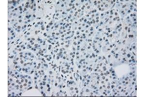 Immunohistochemical staining of paraffin-embedded lung tissue using anti-MAP2K2mouse monoclonal antibody. (MEK2 抗体)