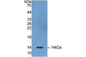 Western blot analysis of the recombinant protein. (beta-Thromboglobulin 抗体  (AA 59-128))