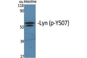 Western Blot (WB) analysis of specific cells using Phospho-Lyn (Y508) Polyclonal Antibody. (LYN 抗体  (pTyr508))