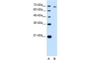 WB Suggested Anti-TARS Antibody Titration:  5. (TARS 抗体  (N-Term))