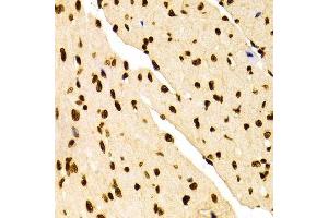 Immunohistochemistry of paraffin-embedded Mouse heart using DiMethyl-Histone H3-K27 antibody. (Histone 3 抗体  (H3K27me))