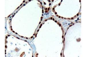 PAX8 polyclonal antibody  staining (3 ug/mL) of paraffin embedded human thyroid gland. (PAX8 抗体)
