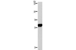 Western Blotting (WB) image for anti-Protein Phosphatase 3, Catalytic Subunit, alpha Isoform (PPP3CA) antibody (ABIN2429663) (PPP3CA 抗体)