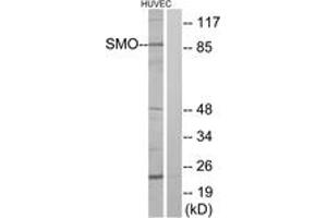 Western blot analysis of extracts from HuvEc cells, using SMO Antibody. (SMO 抗体  (AA 68-117))