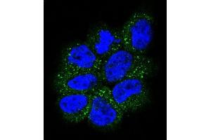 Confocal immunofluorescent analysis of NRAS Antibody (N-term) (ABIN392152 and ABIN2841877) with NCI- cell followed by Alexa Fluor 488-conjugated goat anti-rabbit lgG (green).