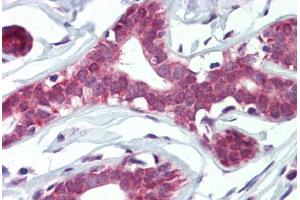 Human Breast (formalin-fixed, paraffin-embedded) stained with ELF4 antibody ABIN462321 followed by biotinylated goat anti-rabbit IgG secondary antibody ABIN481713, alkaline phosphatase-streptavidin and chromogen. (Elf4 抗体  (AA 211-237))