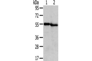 Gel: 8 % SDS-PAGE,Lysate: 40 μg,Lane 1-2: Human normal liver tissue, Human kidney tissue,Primary antibody: ABIN7131406(TMPRSS5 Antibody) at dilution 1/300 dilution,Secondary antibody: Goat anti rabbit IgG at 1/8000 dilution,Exposure time: 5 minutes (TMPRSS5 抗体)
