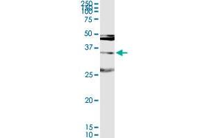 MAGEA9 MaxPab rabbit polyclonal antibody. (MAGEA9 抗体  (AA 1-315))