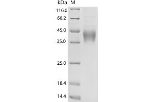 (Tris-Glycine gel) Discontinuous SDS-PAGE (reduced) with 5 % enrichment gel and 15 % separation gel.