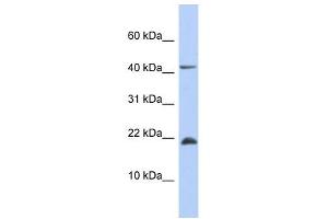 SFRS12IP1 antibody used at 1 ug/ml to detect target protein. (SFRS12IP1 抗体  (Middle Region))