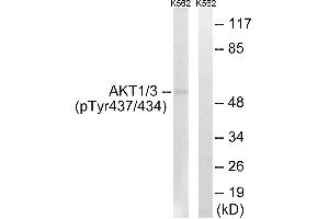 Immunohistochemistry analysis of paraffin-embedded human brain tissue using AKT1/3 (Phospho-Tyr437/434) antibody. (AKT1/3 (pTyr434), (pTyr437) 抗体)