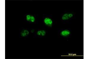 Immunofluorescence of purified MaxPab antibody to FBXO7 on HeLa cell. (FBXO7 抗体  (AA 1-522))