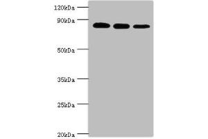 Western blot All lanes: X-ray repair cross-complementing protein 5 antibody at 2 μg/mL Lane 1: A549 whole cell lysate Lane 2: MCF-7 whole cell lysate Lane 3: 293T whole cell lysate Secondary Goat polyclonal to rabbit IgG at 1/10000 dilution Predicted band size: 83 kDa Observed band size: 83 kDa (XRCC5 抗体  (AA 543-732))
