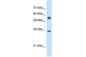 WB Suggested Anti-SSR1 Antibody Titration:  0. (SSR1 抗体  (N-Term))