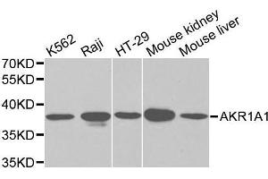 Western blot analysis of Y79 cell and Jurkat cell lysate using AKR1A1 antibody. (AKR1A1 抗体  (AA 1-325))