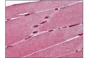 Immunohistochemistry (IHC) image for anti-Cellular Retinoic Acid Binding Protein 1 (CRABP1) (AA 1-137), (N-Term) antibody (ABIN400870) (CRABP1 抗体  (N-Term))