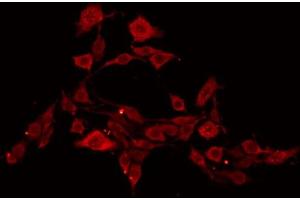 ABIN6269106 staining NIH-3T3 by IF/ICC. (EIF4E 抗体  (C-Term))