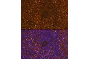 Immunofluorescence analysis of rat spleen using CD30 Rabbit mAb (ABIN7271072) at dilution of 1:100 (40x lens).