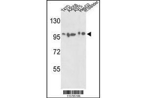 Western blot analysis of ACTN4 Antibody in T47D, A2058, A375, HepG2 cell line and mouse bladder tissue lysates (35ug/lane) (alpha Actinin 4 抗体  (C-Term))