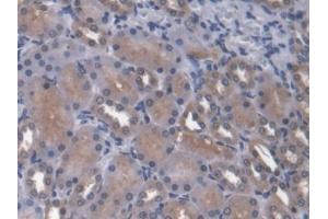 DAB staining on IHC-P; Samples: Rat Kidney Tissue (ANGPTL4 抗体  (AA 228-389))
