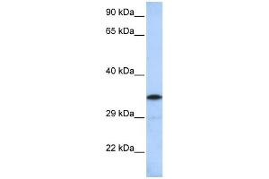 WB Suggested Anti-KCTD4 Antibody Titration:  0. (KCTD4 抗体  (Middle Region))