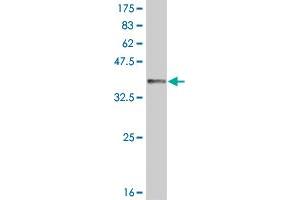 Western Blot detection against Immunogen (36. (IRAK2 抗体  (AA 111-210))