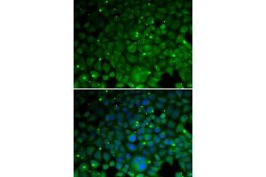 Immunofluorescence analysis of HeLa cells using CRYAA antibody. (CRYAA 抗体  (AA 1-173))