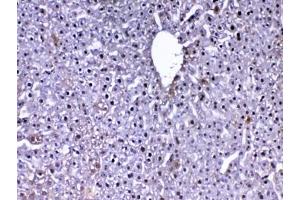 IHC testing of FFPE mouse liver tissue with DJ-1 antibody at 1ug/ml. (PARK7/DJ1 抗体)