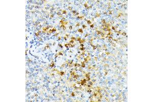 Immunohistochemistry (IHC) image for anti-Spectrin alpha 1, Erythrocytic (SPTA1) (AA 940-1160) antibody (ABIN6148401)