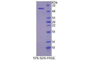 SDS-PAGE analysis of Human MYLK Protein. (MYLK 蛋白)