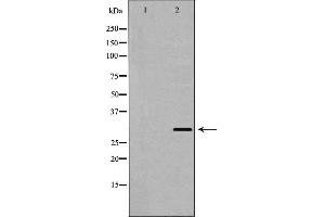 Western blot analysis of Hela whole cell lysates, using PSMF1 Antibody. (PSMF1 抗体  (C-Term))