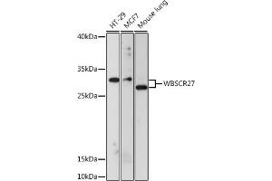 Western blot analysis of extracts of various cell lines, using WBSCR27 antibody (ABIN7271366) at 1:1000 dilution. (WBSCR27 抗体  (AA 1-245))