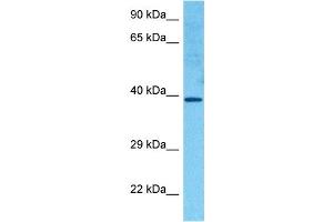 Host:  Rabbit  Target Name:  HOXC11  Sample Tissue:  Human RPMI 8226 Whole Cell  Antibody Dilution:  1ug/ml (HOXC11 抗体  (Middle Region))