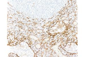 Immunohistochemistry (IHC) image for anti-Thrombomodulin (THBD) (AA 17-515) antibody (ABIN7795644)