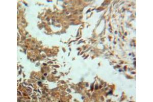 Used in DAB staining on fromalin fixed paraffin-embedded ovary tissue (ENPP2 抗体  (AA 637-905))