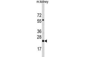 Western Blotting (WB) image for anti-Phosphatidylethanolamine N-Methyltransferase (PEMT) antibody (ABIN5015225) (PEMT 抗体)