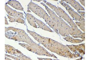 Immunohistochemistry (IHC) image for anti-DNA (Cytosine-5)-Methyltransferase 1 (DNMT1) (AA 22-126) antibody (ABIN5693103)