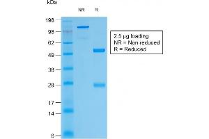 SDS-PAGE Analysis of Purified Thyroglobulin Rabbit Recombinant Monoclonal Antibody (TGB/1968R). (Recombinant Thyroglobulin 抗体)