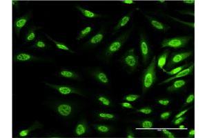 Immunofluorescence of monoclonal antibody to OXSR1 on HeLa cell. (OXSR1 抗体  (AA 351-450))