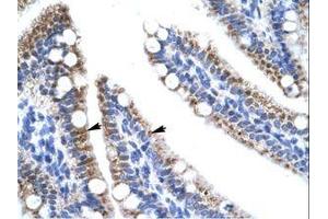 Image no. 1 for anti-Zinc Finger Protein 12 (ZNF12) (AA 73-122) antibody (ABIN202669) (ZNF12 抗体  (AA 73-122))