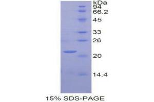 SDS-PAGE (SDS) image for Glucosidase, Alpha, Acid (GAA) (AA 761-919) protein (His tag) (ABIN1877338)