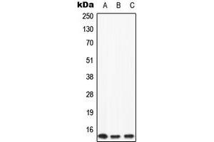 Western blot analysis of Apolipoprotein C2 expression in HeLa (A), mouse liver (B), rat liver (C) whole cell lysates. (Apolipoprotein C-II 抗体  (Center))