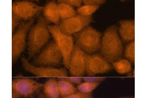 Immunofluorescence (IF) image for anti-Zinc Finger CCCH-Type Containing 7A (ZC3H7A) antibody (ABIN7256700)