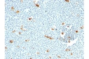 Formalin-fixed, paraffin-embedded human Tonsil stained with Macrophage Monoclonal Antibody (LN-5) (Macrophage / Histiocytoma Marker 抗体)