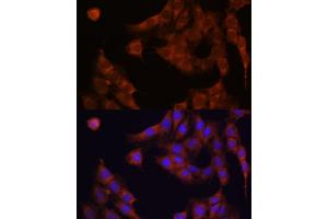 Immunofluorescence analysis of C6 cells using GANAB antibody  at dilution of 1:100. (GANAB 抗体  (AA 1-260))