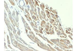 Immunohistochemistry (IHC) image for anti-Enolase 2 (Gamma, Neuronal) (ENO2) (AA 416-433) antibody (ABIN6939308)