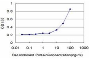 Detection limit for recombinant GST tagged DLD is approximately 1ng/ml as a capture antibody. (DLD 抗体  (AA 1-509))