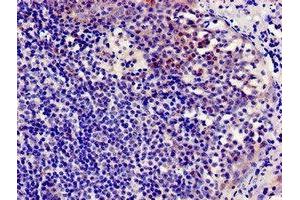 Immunocytochemistry analysis of human tonsil tissue using ABIN7145942 at dilution of 1:100 (CCR7 抗体  (AA 332-378))