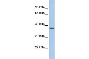 Western Blotting (WB) image for anti-Synaptotagmin IX (SYT9) (N-Term) antibody (ABIN2785341) (SYT9 抗体  (N-Term))